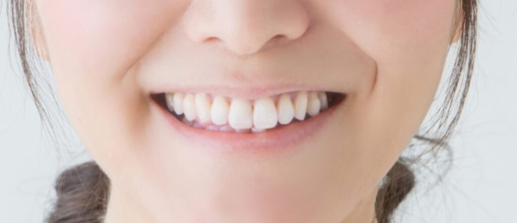 歯並び/かみ合わせ/顎関節症